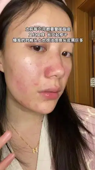 这么多年玫瑰脂皮, 走到现在实属不易!