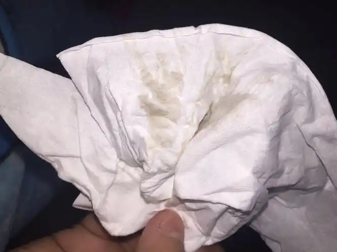 今天下面流点东西 好像是褐色的但又好像是血 人生第一次这样 是不是
