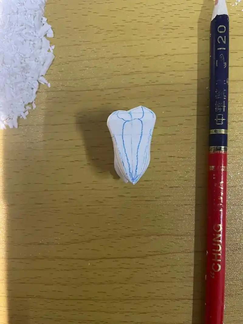 右上颌第一磨牙牙体雕刻(1.5倍)#雕牙 - 抖音