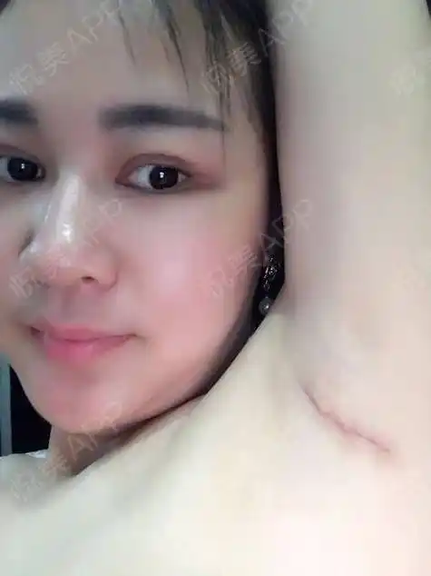 为什么做梦梦到自己胸变大(梦见自己胸部变大了怎么回事)