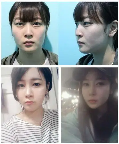 韩国人整容前后对比 多图