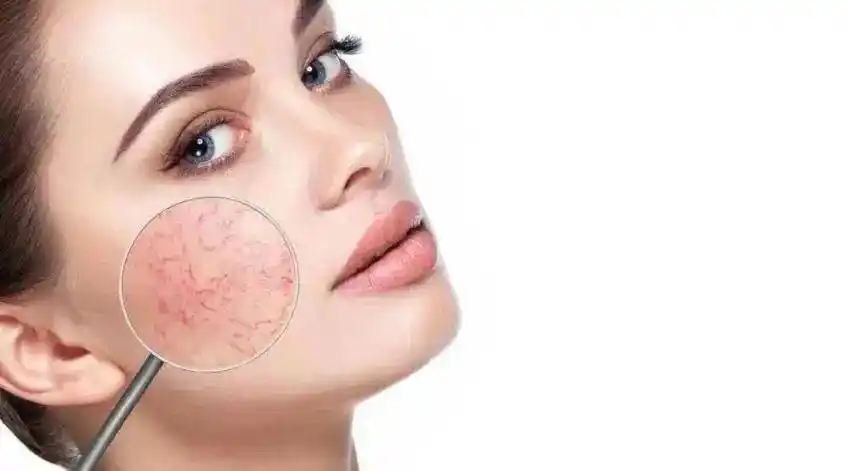 怎样算是问题性肌肤?快看看你有没有中招_皮肤_色斑_色素