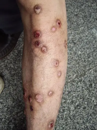 来一个典型病例图片1