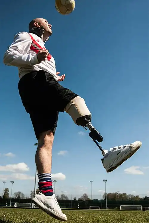 上肢假肢,小腿假肢,假肢价格,假肢定制,假肢公司-恩德莱