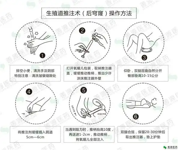 氧媚儿妇科常规操作方法