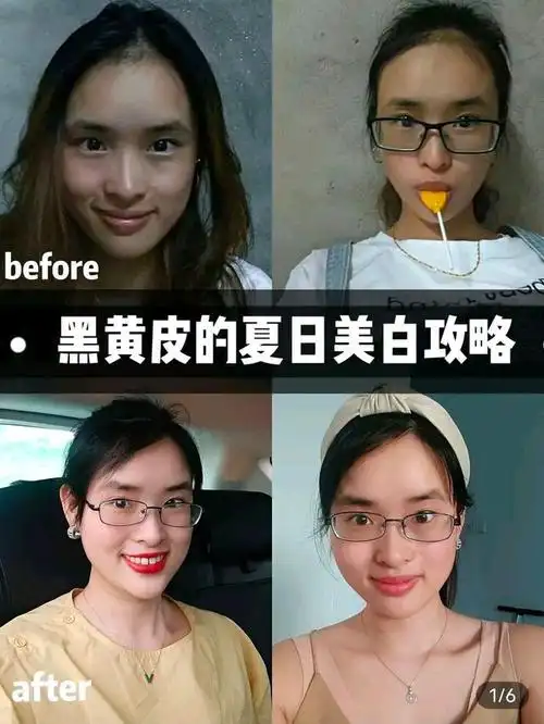 多年皮肤管理,我终于变白了!