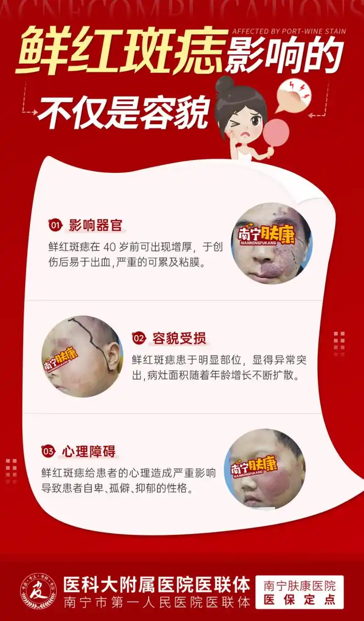 南宁肤康皮肤病医院是三甲的?