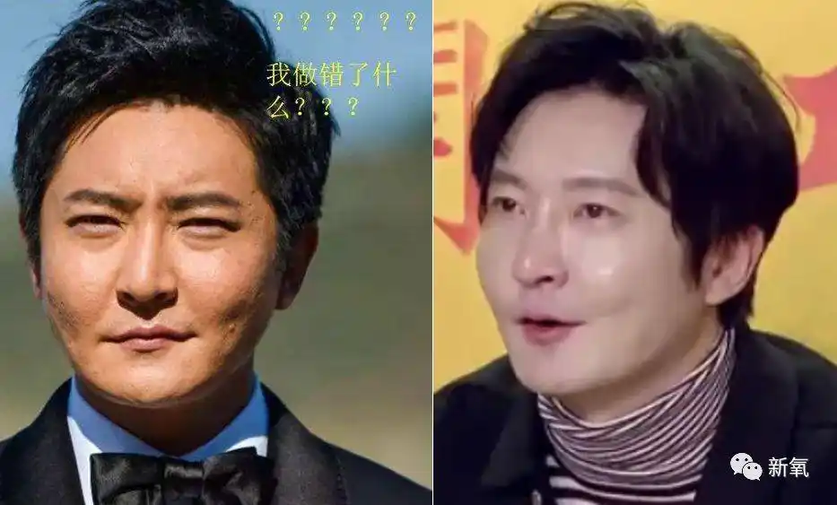 当红偶像上节目现场脸崩了赶去缝针……?_郭京飞