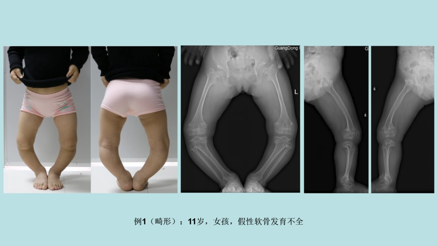 省妇幼骨科疑难杂症门诊,开诊了