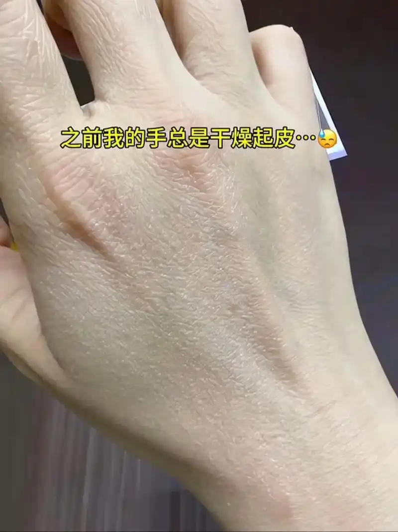 一定要试试这款手膜!细腻