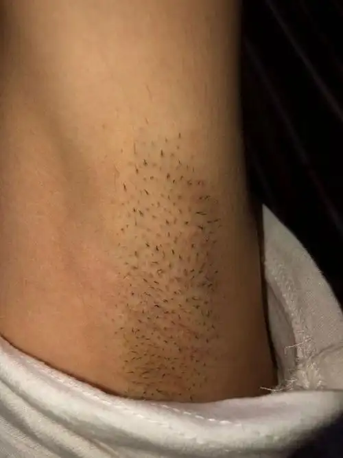 有什么效果好的脱毛膏对身体没有危害