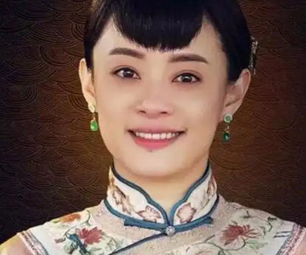 孙俪下巴的痣怎么回事 为什么名人的痣都不愿意去(2)