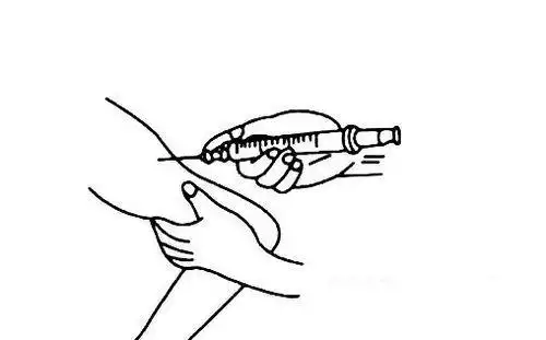 医院打针步骤图简笔画