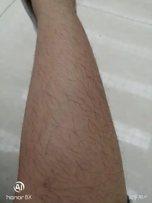 女生腿毛多是一种什么体验?