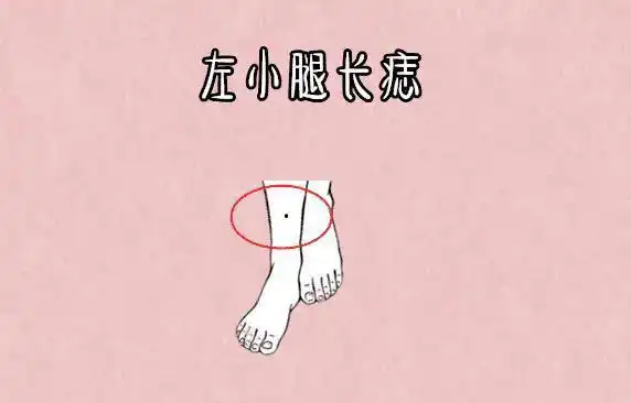 恶痣|左小腿|额角_网易订阅