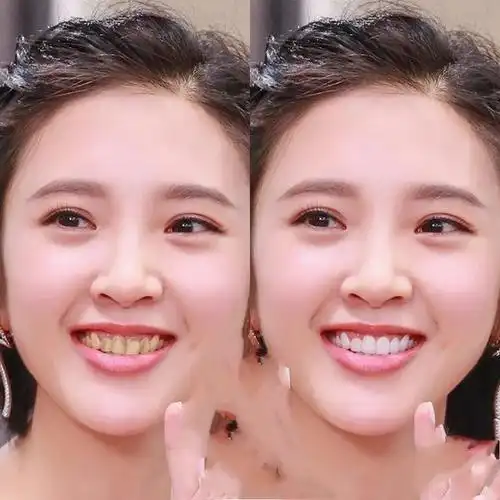 关于洁白牙齿灿烂微笑的手抄报牙齿手抄报