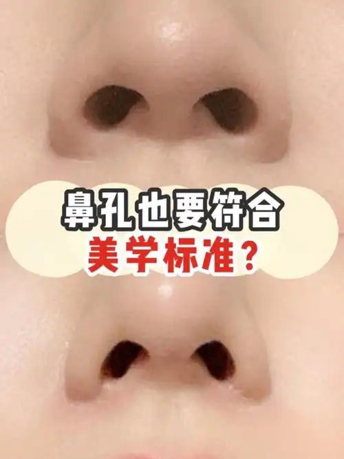 现在的人,对美的要求已经上升到考量鼻孔的好看程度了.