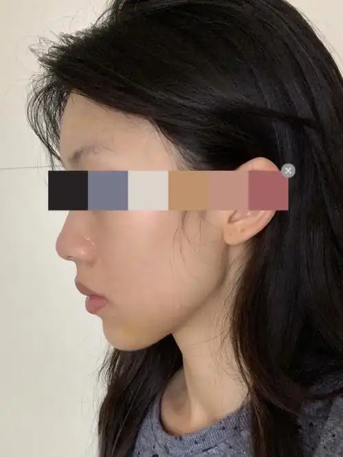 太长,加上工作的原因迟迟没有下手,于是做了功课想先做个下巴过度一下