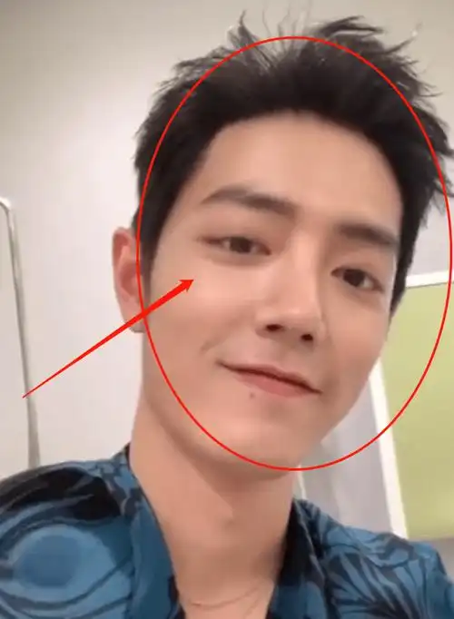 肖战的头发真的整个炸掉了,虽然肖战的头发看起来茂密,但是他的发际线