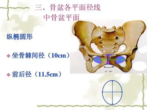 三,骨盆各平面径线 中骨盆平面 纵椭圆形   坐骨棘间径(10cm) 前后径