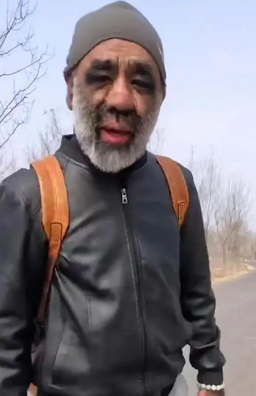 毛孩于震寰为爱被逼脱毛42岁娶90后娇妻如今成人生赢家