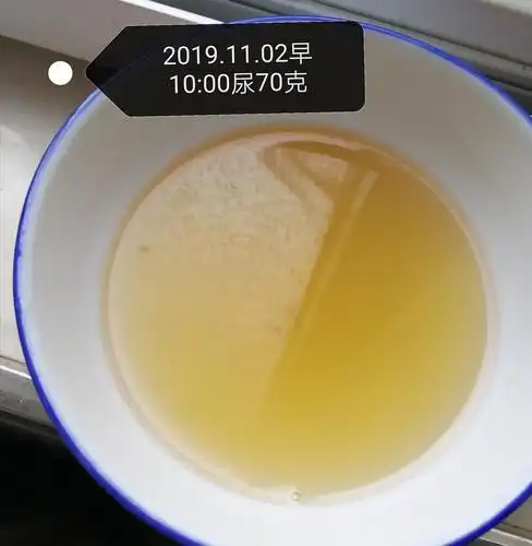 10.24-11.3肝热没食欲尿结晶反复