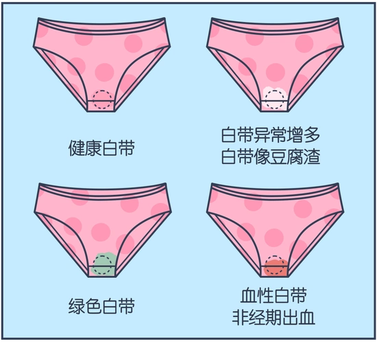 私处_进行_细菌