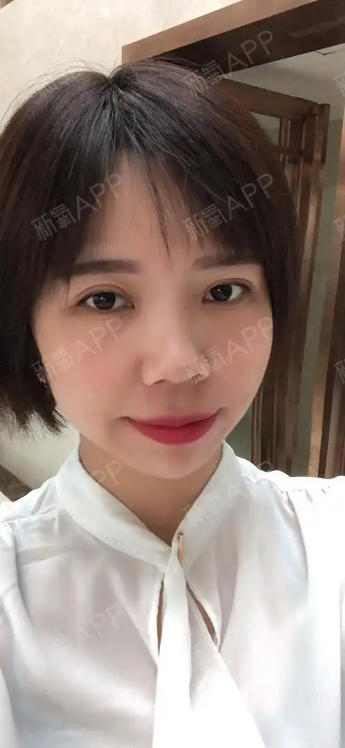 玻尿酸填充泪沟的第三天,效果真的很明显,之前一直以_圈子-新氧美容