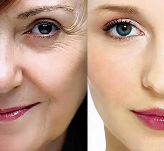 怎么提升面部皮肤