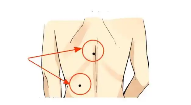 身上有这三颗大吉痣,最有福气,注定一生大富大贵,好运连连!