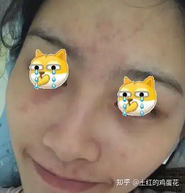 我经常熬夜,皮肤越来越差了,所以想入手一款对熬夜有效地面膜,请问谁