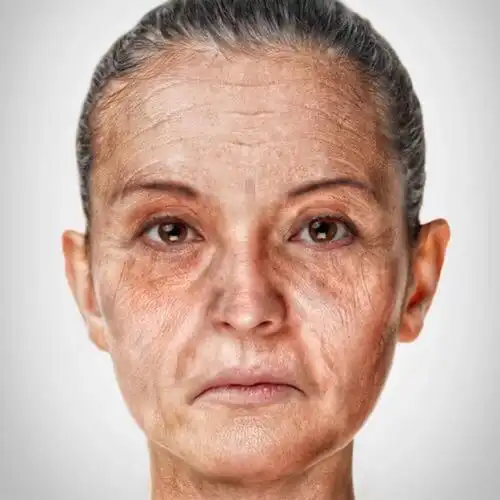 [费解][费解]_圈子-新氧美容整形