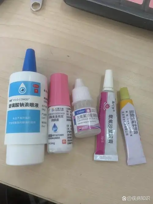 过敏性结膜炎 麦粒肿