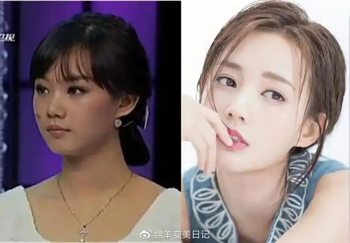 图片图片对比过往的照片,可以看到李一桐在肤质和肤色上也有着很大的