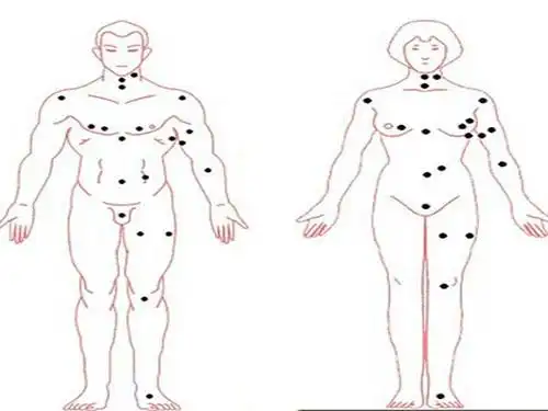 身体上的痣相密码人体痣相面面观一