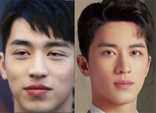 取假体紧致皮肤修复双眼皮明星整容失败想要回春得多努力