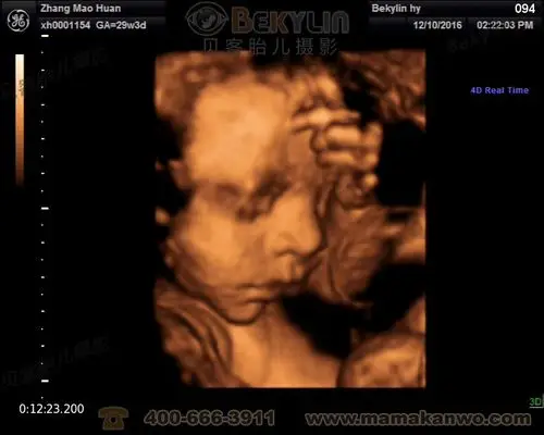 宝宝四维照片,大家看是男孩还是女孩