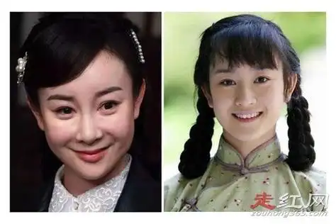 张檬整容记图片判若两人变化好大而且整残了