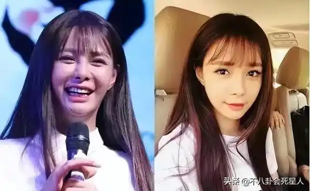 沈梦辰整容了了吗(沈梦辰第二次整容前后对比照) - 帮企客