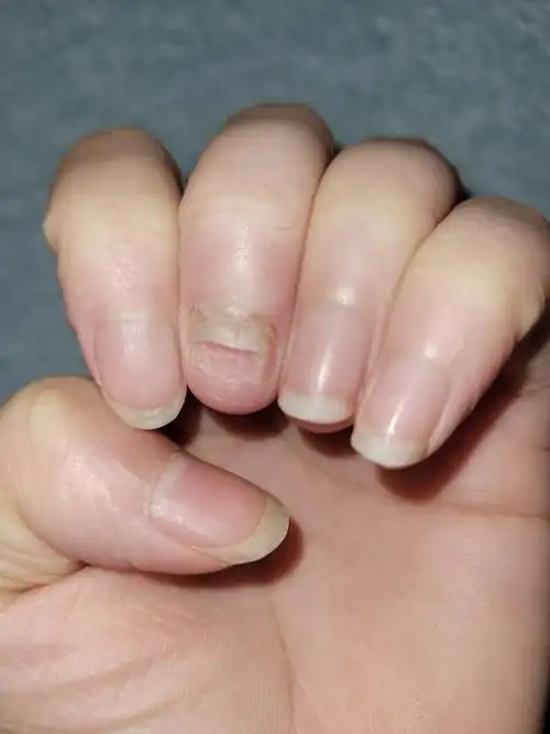 甲基受损求助我该怎么养呢