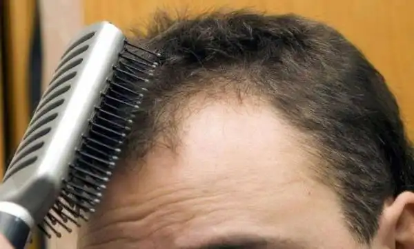 各种防脱洗发水,生发水赫然在列,这个帖子引发了很多有脱发困扰的90后