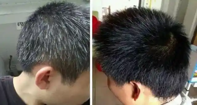 首乌洗发水用了之后白发可以变黑发吗