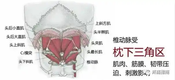 针灸治疗枕下三角区综合征