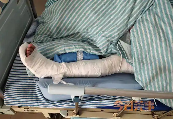 东莞一男子醉驾遇查车逃跑慌不择路摔断腿