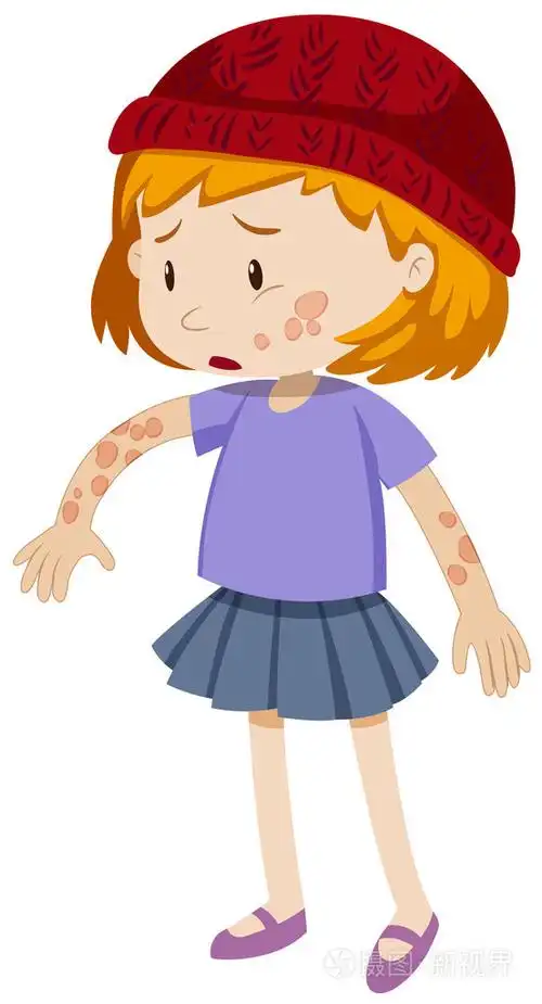 小女孩,在她身上的癣