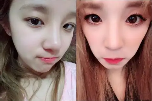 宋雨琦的变脸史比baby还丰富?出道前的照片实在是