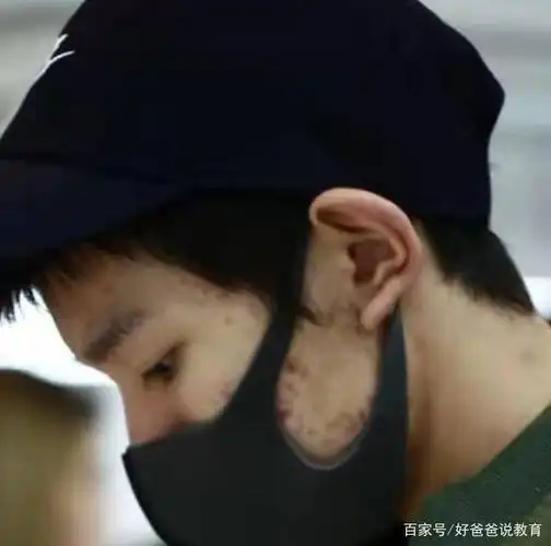 王源粉丝脱粉回踩,爆出王源丑照:颜值,脸蛋都很虐人