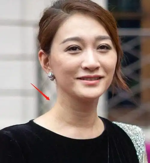 赵丽颖的毛孔宋轶的黑头离开滤镜的明星治好了我的容貌焦虑