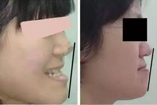 不动刀就能改变脸型的方法?细数杨幂baby变脸史