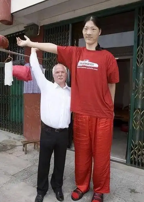 安徽世界第一女巨人穿78码鞋一顿吃6碗面比姚明还高